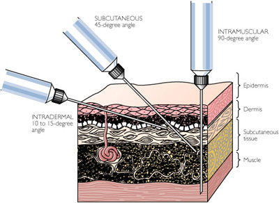 how to inject hgh propertly